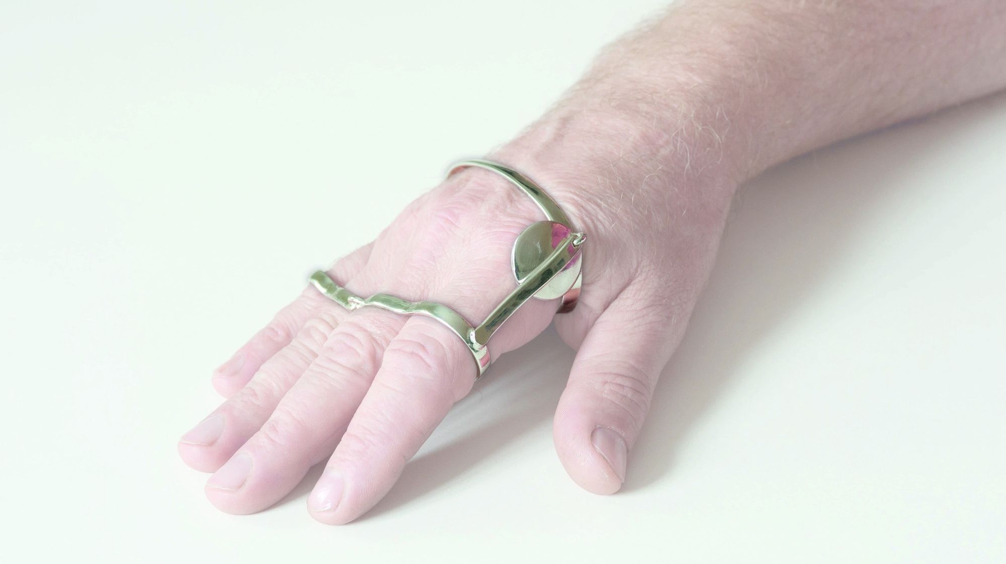 MCP Anti - ulnair deviatie Splint 6023