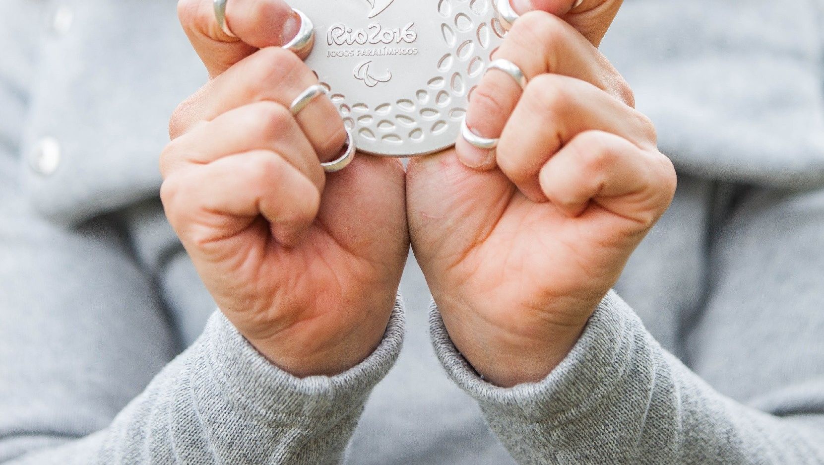 The specialist in Silversplints