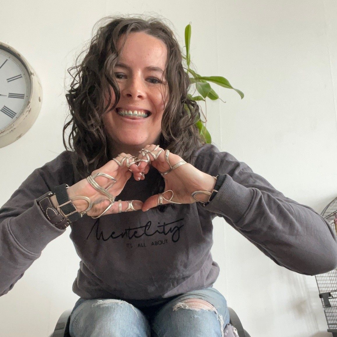 Trouwringen of orthopedisch hulpmiddel?